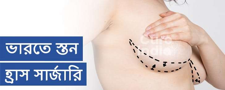 স্তন হ্রাস সার্জারি